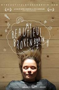 My Beautiful Broken Brain poster